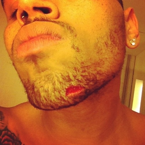 Skadad, Chris Brown, Rappare, Misshandel, Brak, Drake, artister, Nattklubb, kändis, Slagsmål, Flaska, Rihanna