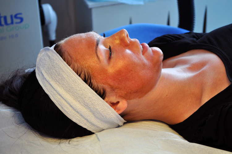 Acneärr, Skin Care Academy, Kemisk peeling, Vi-peel
