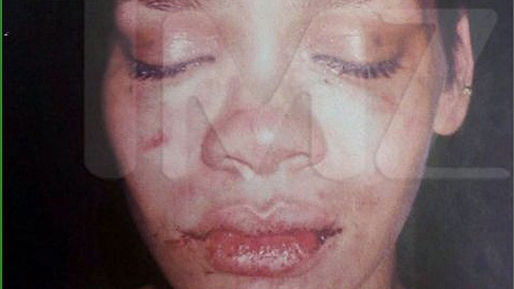 Berns, Chris Brown, Spelning, Misshandel, Globen, Stockholm, Rihanna