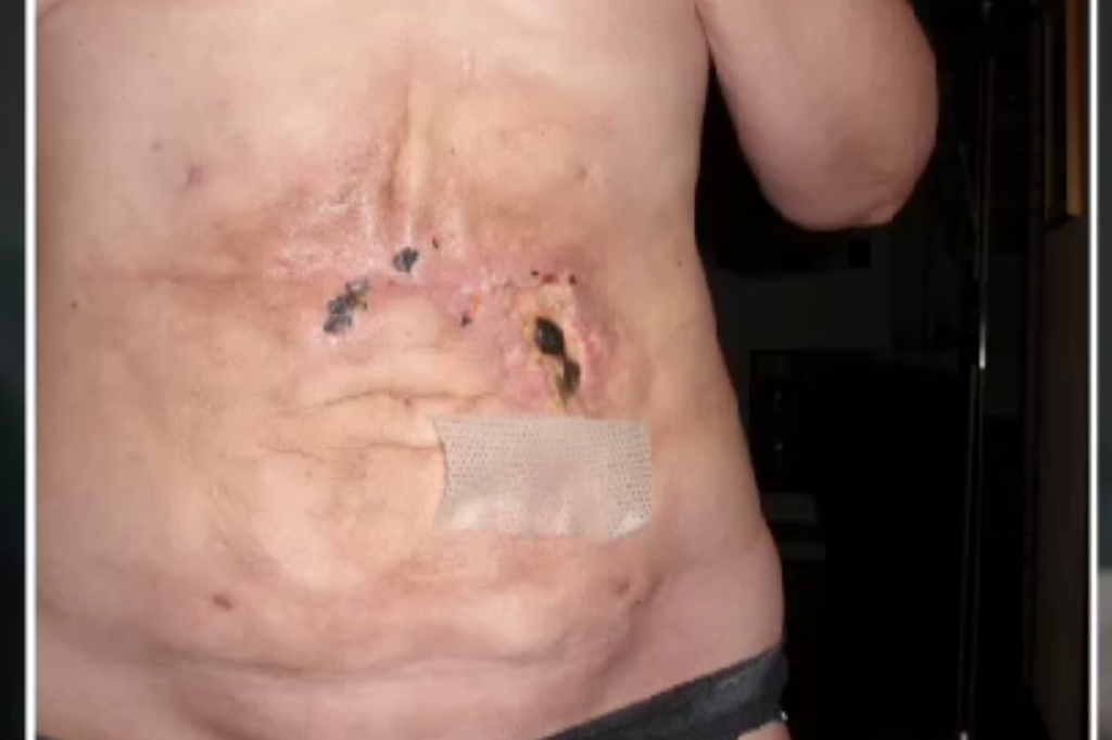 Fettsugning, Skönhetsindustrin, Botox, Laser