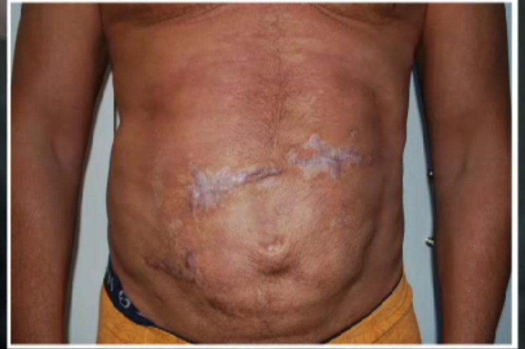Botox, Skönhetsindustrin, Laser, Fettsugning