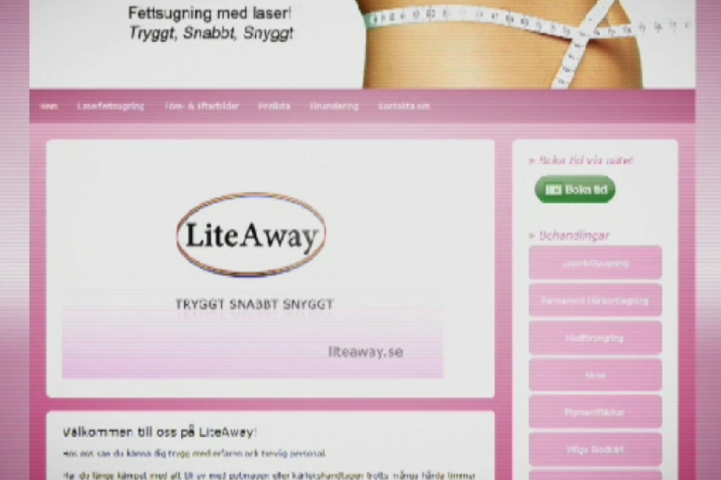 Skönhetsindustrin, Laser, Fettsugning, Botox