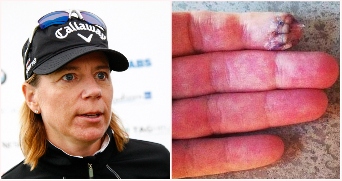 Finger, Golf, Skada, Annika Sörenstam, Kniv