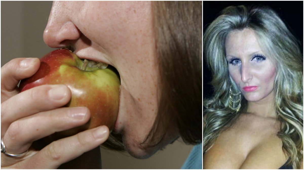 Äpple, Tandläkare, Stämning