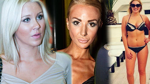 BDD, Kissie, Vikthån, Blondinbella, störning, Bikini, Isabella Löwengrip