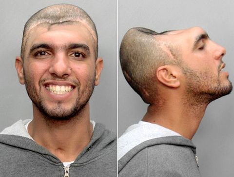 Polis, Carlos Sosa, Sexköpare, sex, Sexbrott, Sexköp, Kriminellt, Prostitution, Mugshot, Halvt huvud, Miami, Carlos Rodriguez