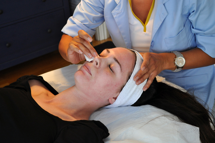 Acneärr, Skin Care Academy, Kemisk peeling, Vi-peel