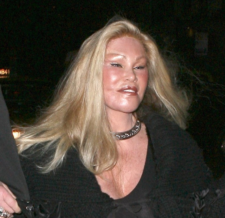 Hollywood, Heidi Montag, Opererad, Plastik