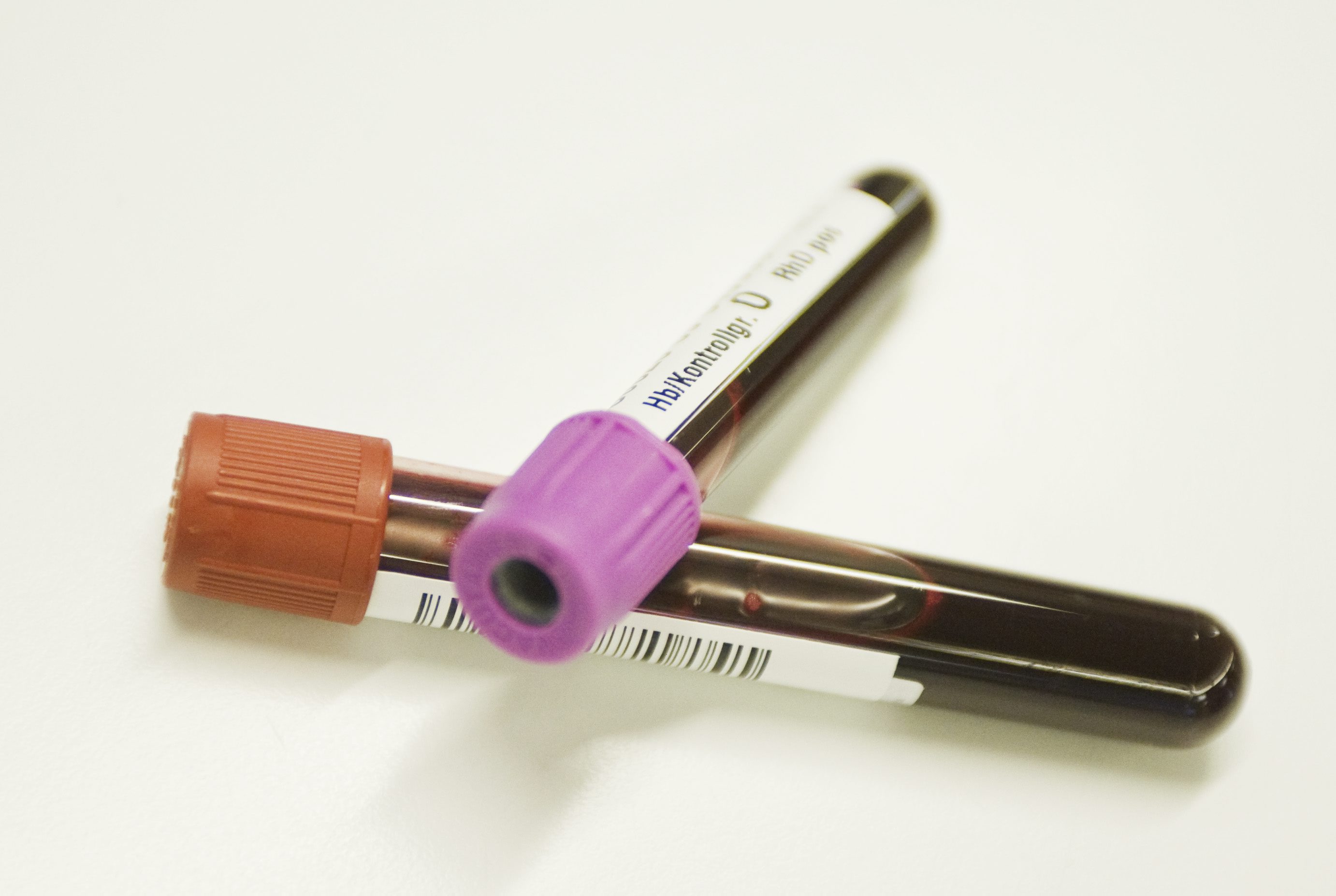 HIV-smittad, Stämd, USA, HIV, Lakare