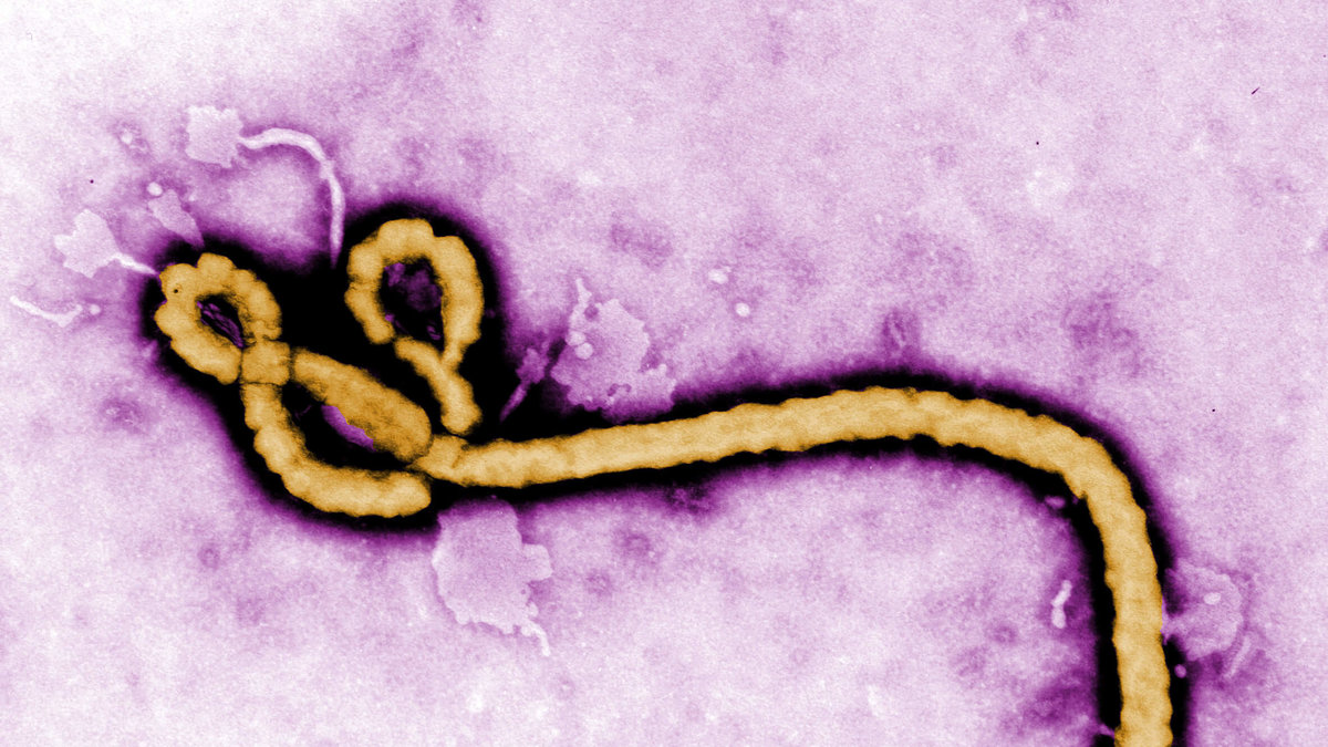 Ebolavirus. 