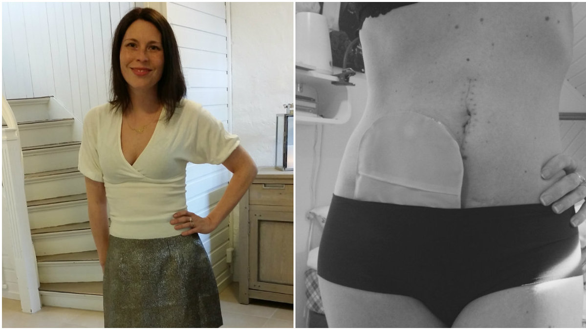 Heidi Torkildson Ryste vill att alla ska lära sig att uppskatta sin friska kropp istället för att oroa sig för hur man ser ut. 