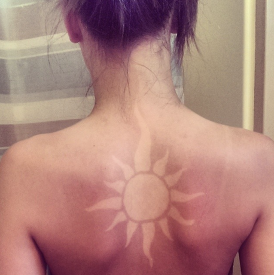 Sunburn art var en trend Sunburn art var en trend