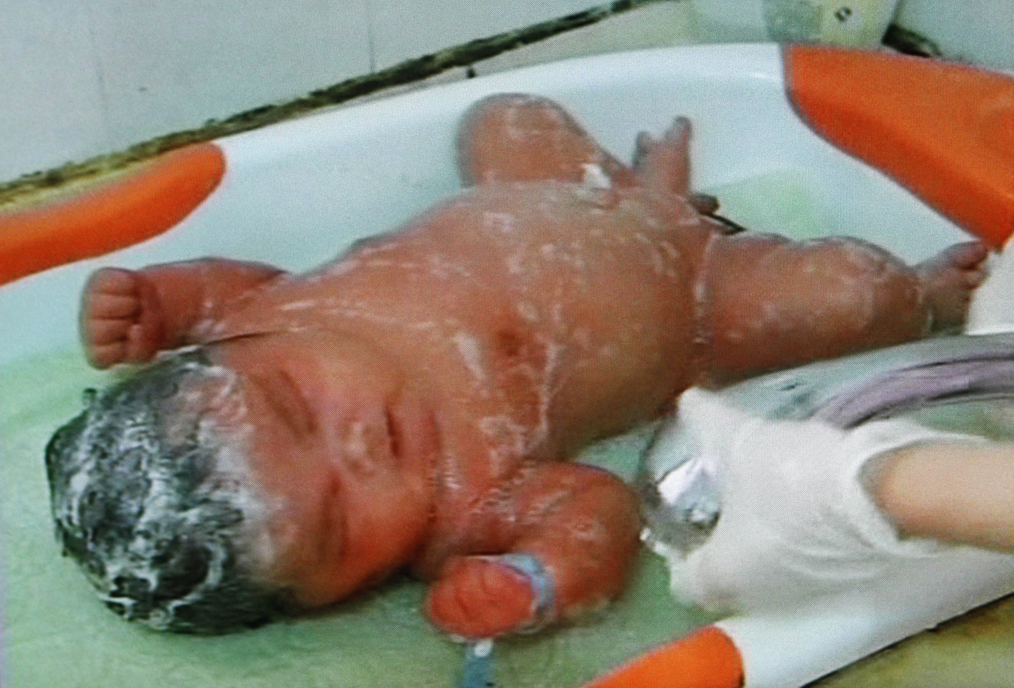 Pojken föddes på Xianxians sjukhus och vägde 7,04 kilo vid födseln.
