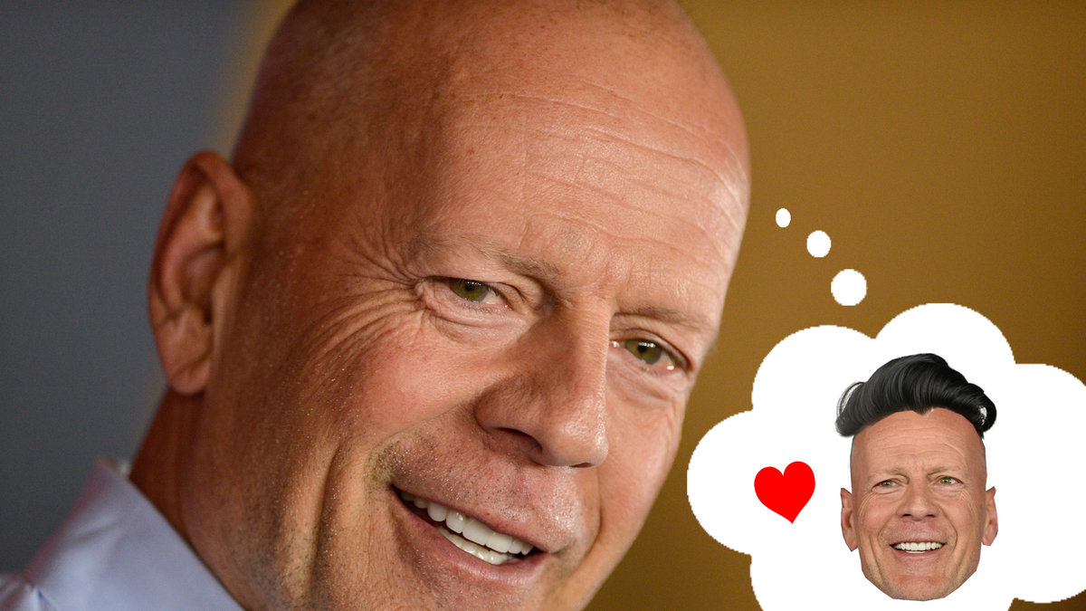 Många drabbas av håravfall, däribland filmstjärnan Bruce Willis.