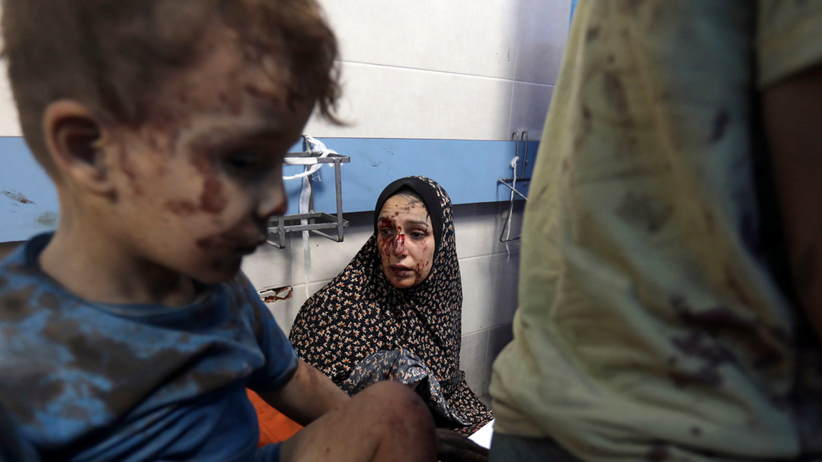 Israels flygräder mot Hamasledda Gaza fortsätter. En palestinsk familj söker vård på al-Shifa-sjukhuset i staden Gaza efter bombardemang.