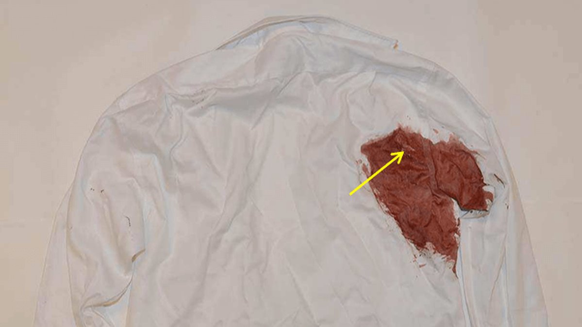 På skjortans baksida var tyget mättat med blod vid höger ärm.