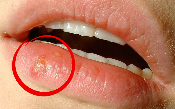 Hur hög flaggstång ska man ha