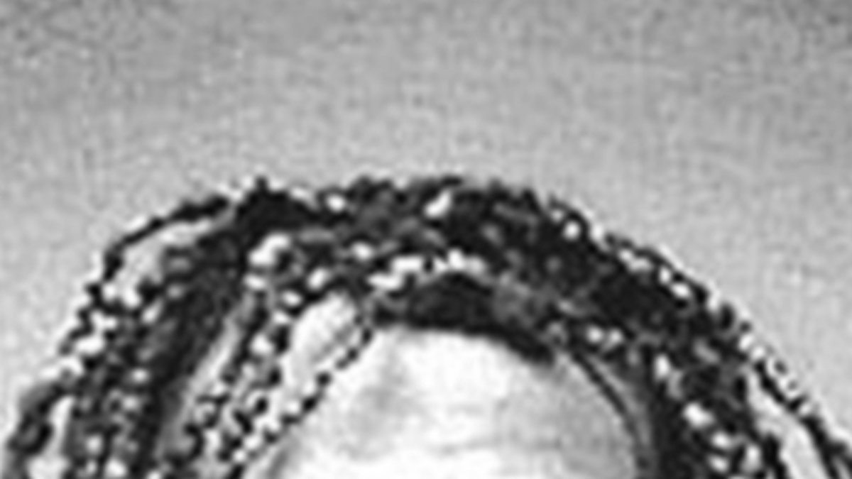 Tommy Lee arresterades 1999 efter att ha startat ett upplopp under en konsert. Det är ännu oklart ifall det var hans frisyr som var själva upploppet. 
