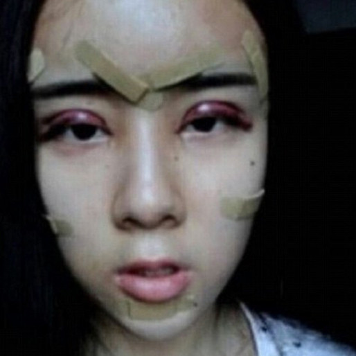 Den kinesiska tonårstjejen Lee Hee Danae är bara 15 år gammal men har redan hunnit med en hel rad skönhetsoperationer. Den kinesiska tonårstjejen Lee Hee Danae är bara 15 år gammal men har redan hunnit med en hel rad skönhetsoperationer.
