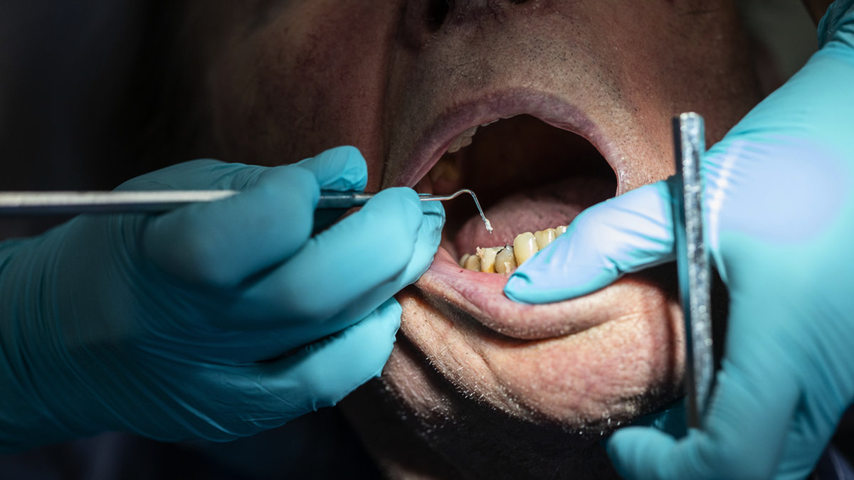 Tandvårdsbolaget My dentist blir av med sitt statliga tandvårdsstöd. Arkivbild.