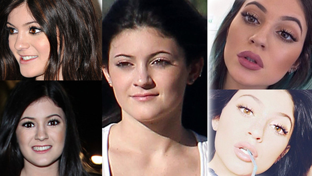 Se 16-åriga Kylie Jenners förvandling här. 
