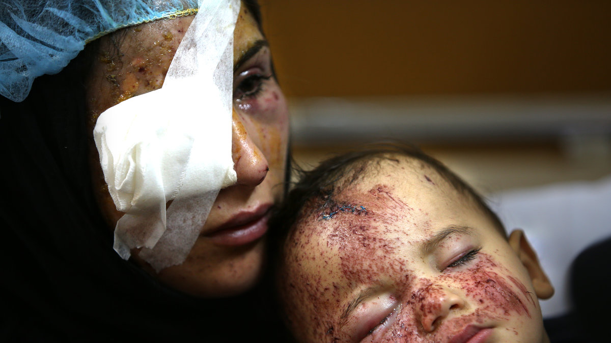 18-åriga Ghadeer och hennes son Mohammed efter att de båda skadats av en bilbomb i staden Hermel, februari 2014. 
