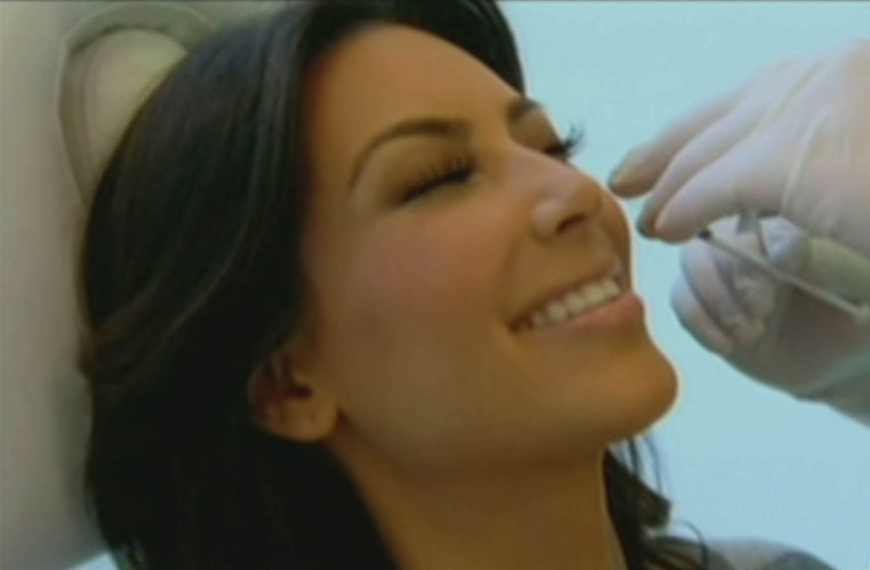 Sedan började Kim med Botox och fillers.
