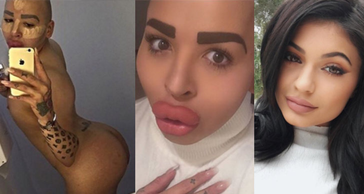 instagram, Botox, Fillers, Jordan James Parke, Kim Kardashian, Kylie Jenner, Operationer