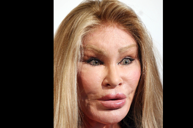 Jocelyn Wildenstein, mer känd som Kattkvinnan, har spenderat över fyrtio miljoner kronor för att se ut som sitt favoritdjur. Jocelyn Wildenstein, mer känd som Kattkvinnan, har spenderat över fyrtio miljoner kronor för att se ut som sitt favoritdjur.