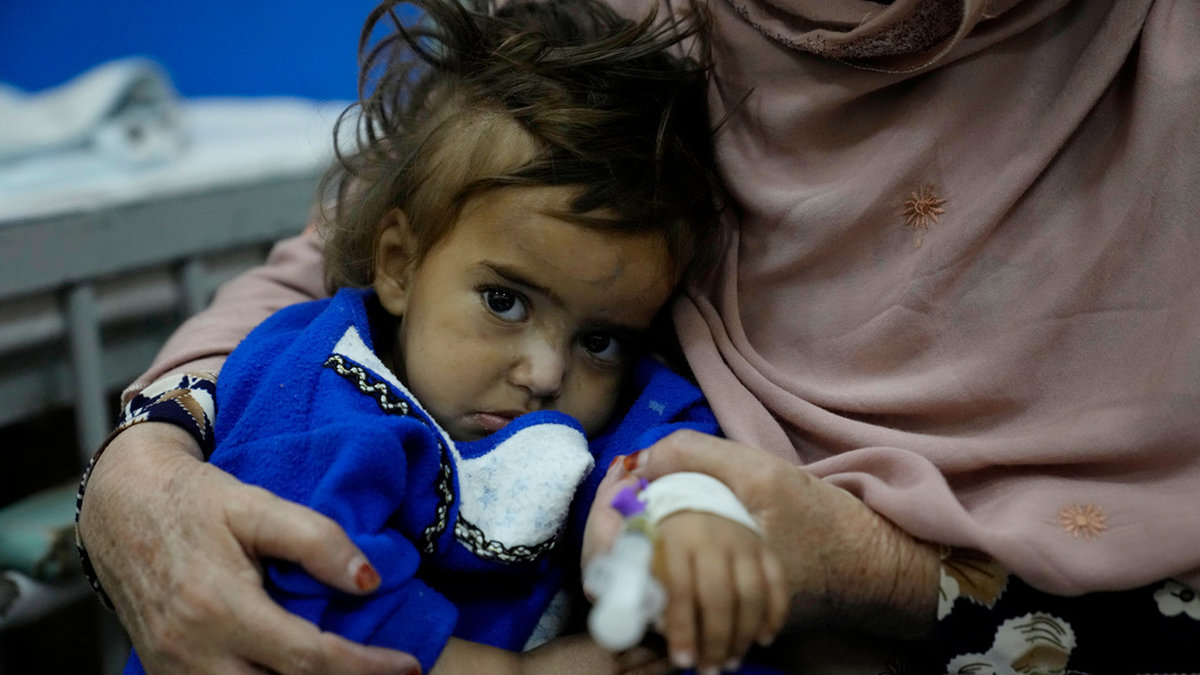 En afghansk flicka vårdas för undernäring på ett sjukhus i Afghanistans huvudstad Kabul. Afghanistan är ett av de länderna i världen där matsäkerheten är som sämst, enligt FN-rapporten. Arkivbild.