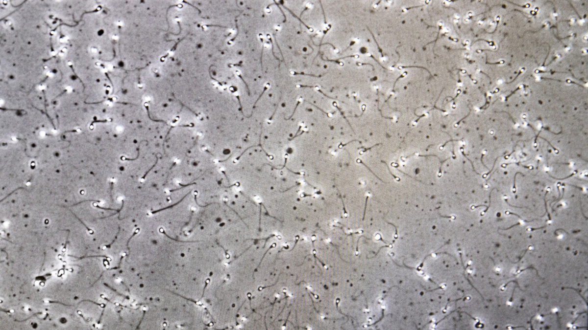 Spermier som används vid assisterad befruktning syns på en dataskärm. Arkivbild.