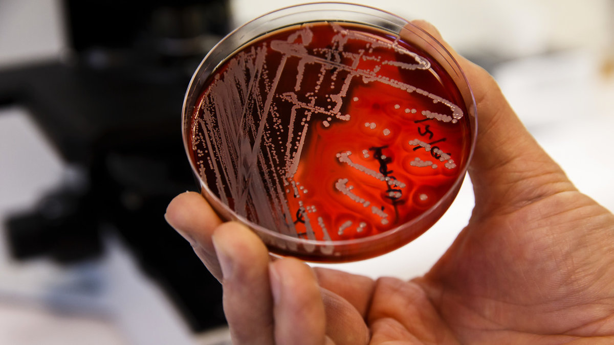 Antibiotikaresistenta bakterier är ett växande problem. Norska forskare har undersökt om det går att minska på användningen vid akuta luftvägsinfektioner. Arkivbild.