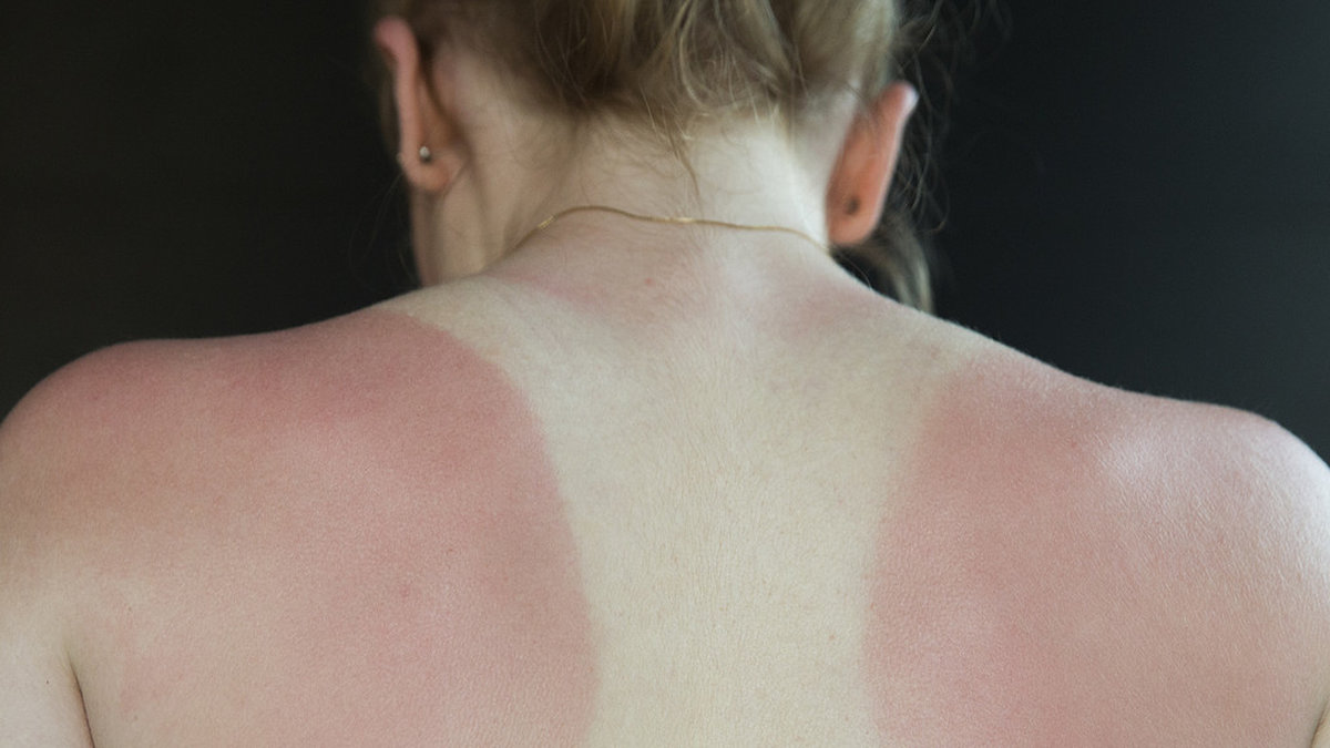 Vilket är bra då solskador kan ge bestående skador på huden.
