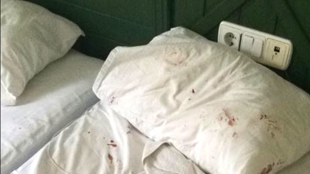 Hotellsängen fylld med blodfläckar efter den påstådda misshandeln.