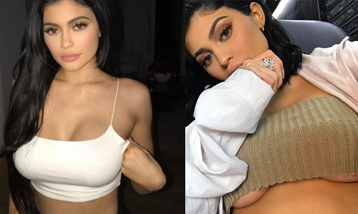 Kylie Jenner, Bröstoperation, Operation