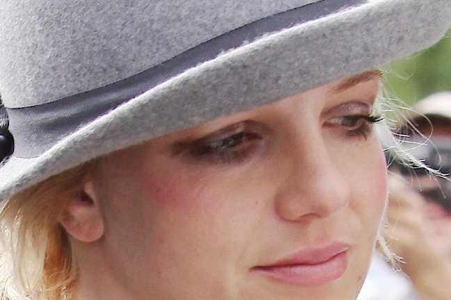 Och den här bilden där Britney till synes har en blåtira runt höger öga uppges också vara ett bevis. 