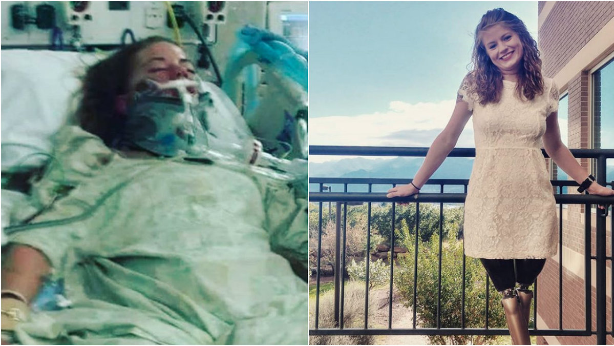 Mandy Horvath förlorade båda sina ben efter att ha blivit drogad på krogen. 