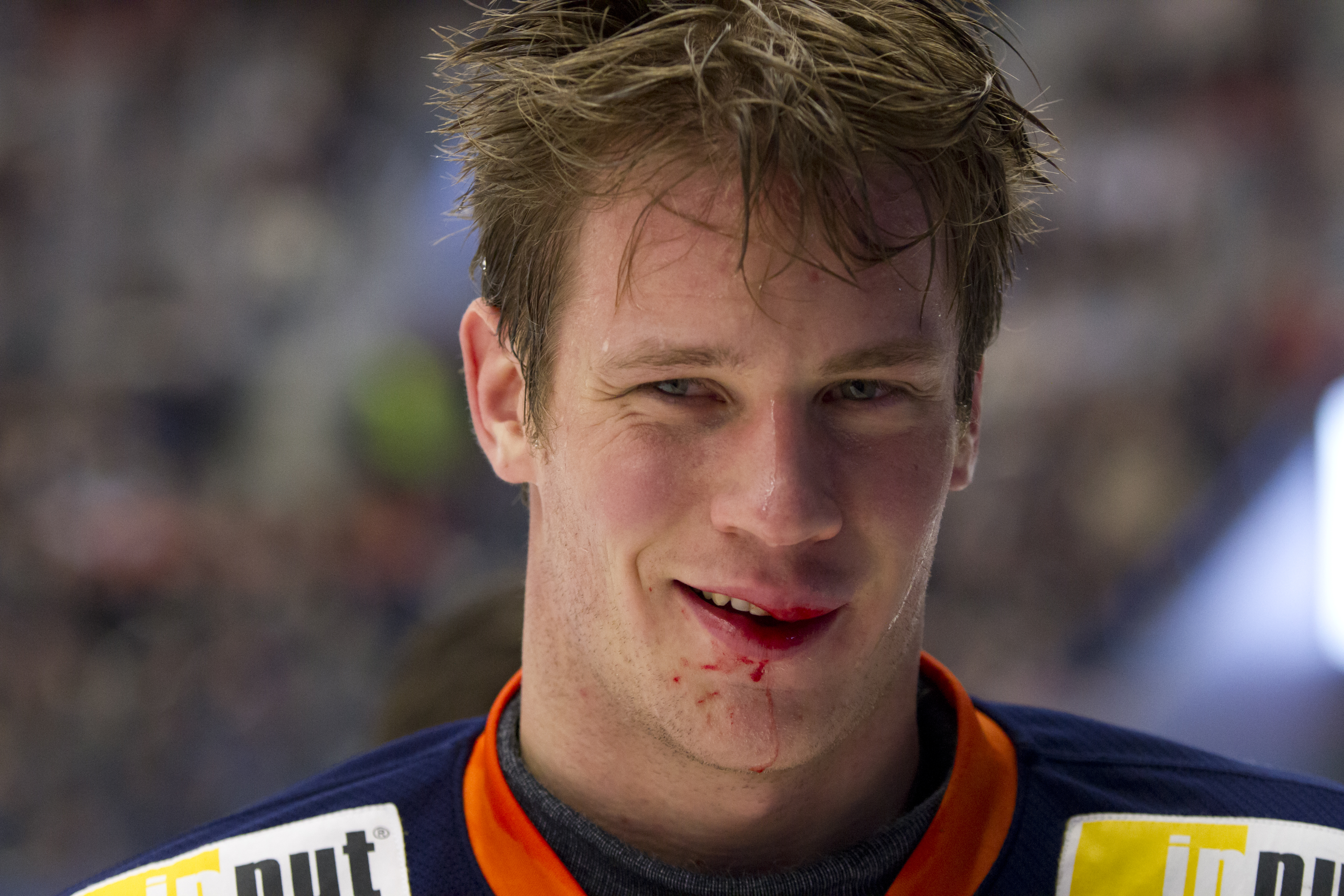 Växjö spelaren Gustav Hjalmarsson född 1986 och måste använda tandskydd.