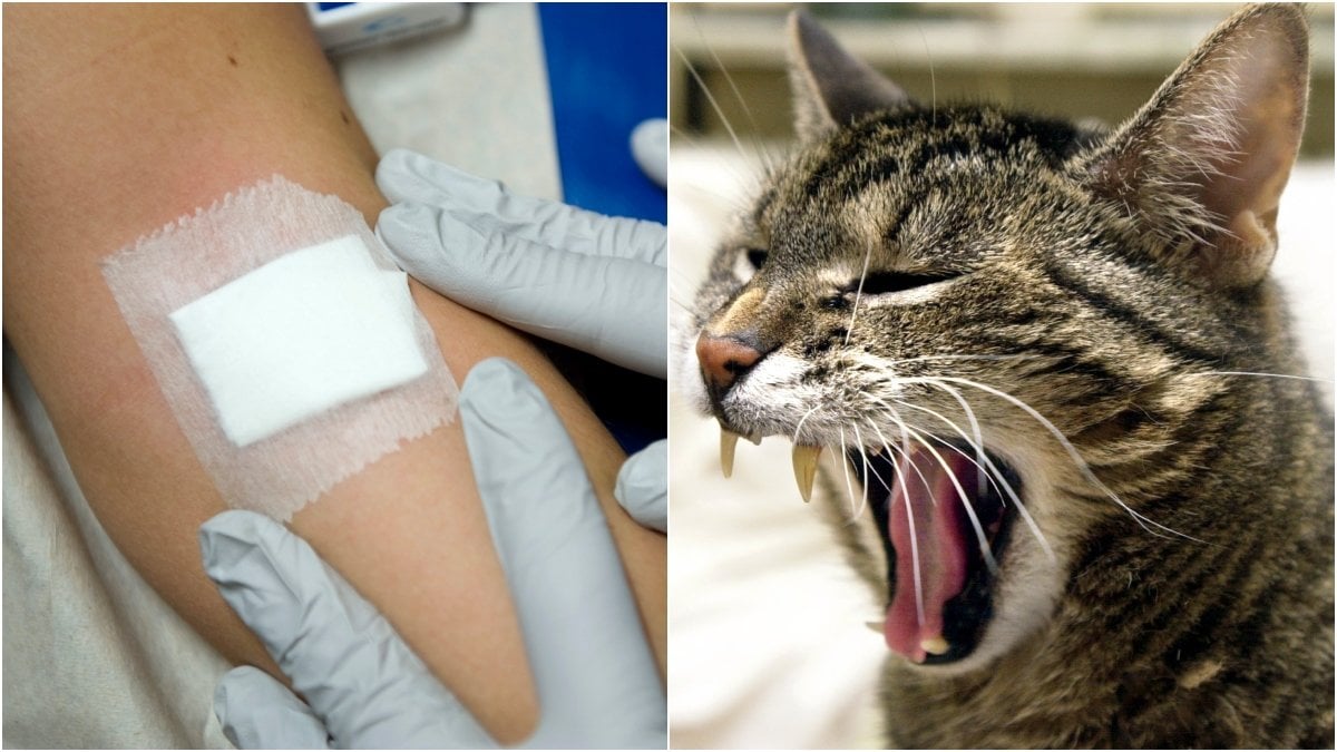 Har du blivit biten eller riven av katten kan du behöva uppsöka sjukvård.