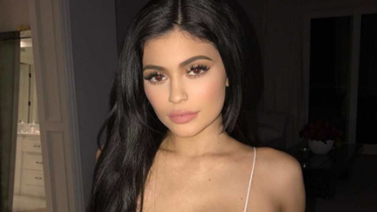 Kylie Jenner har genomgått en radda operationer. 