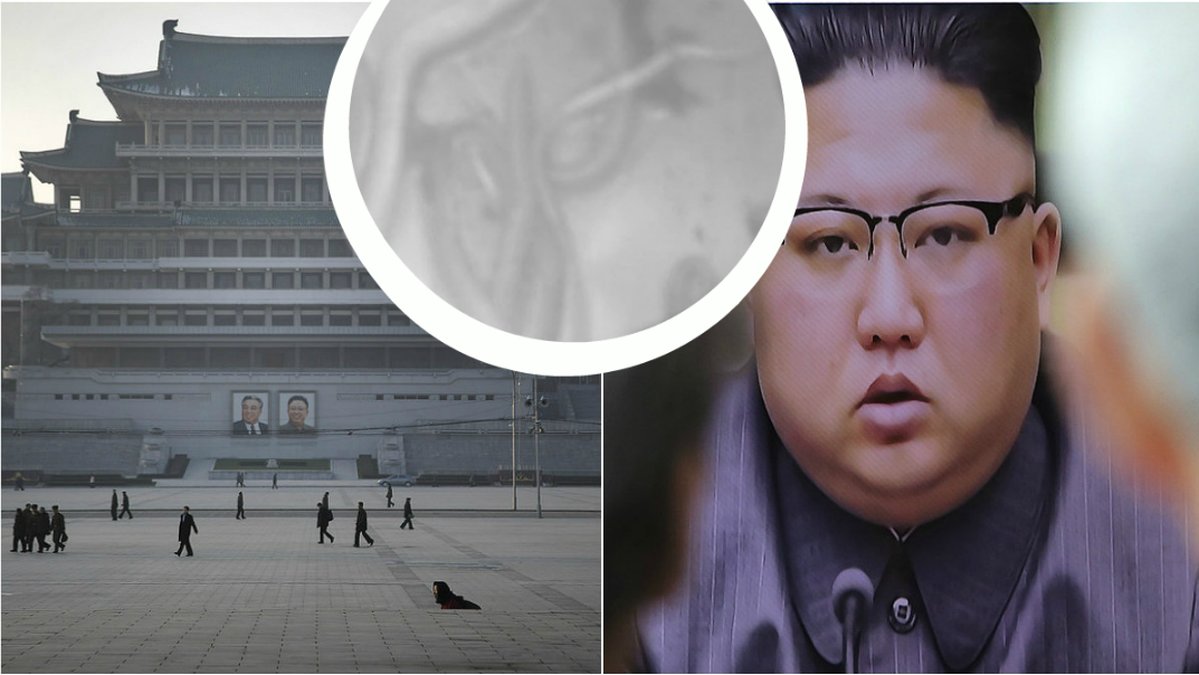 En man har lyckas att fly från Nordkorea. Läkare hittade bland annat en 27 centimeter lång spolmask i hans kropp.