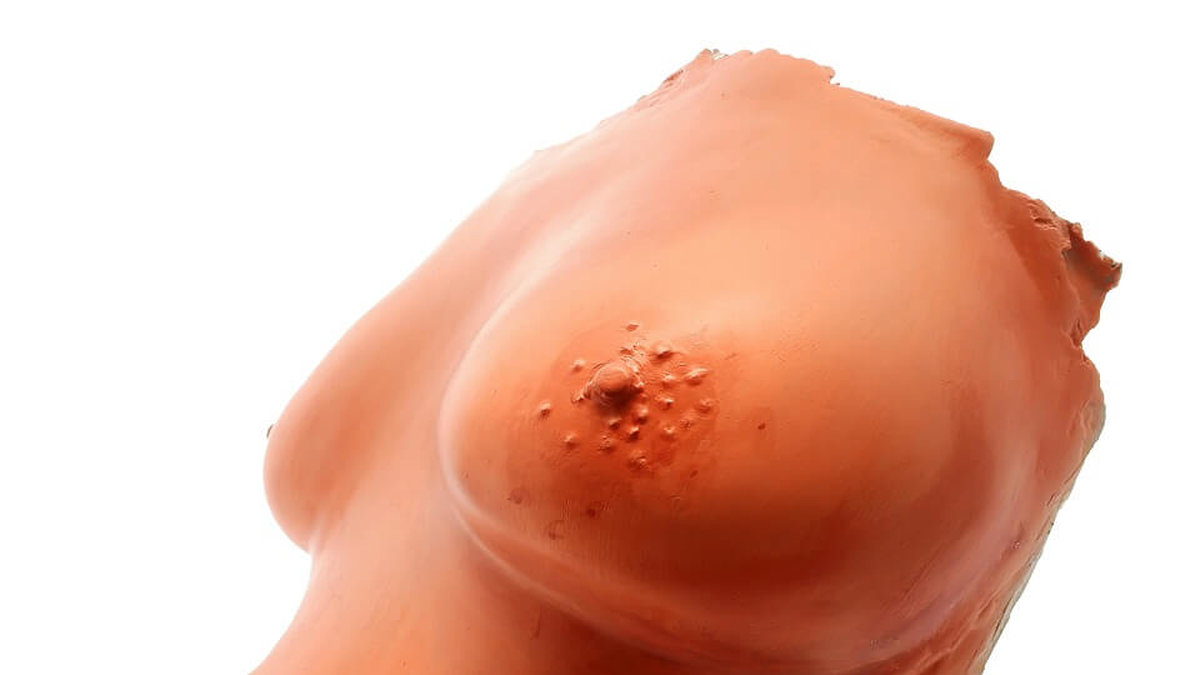 Även bröstvårtorna kan vara olika varandra. Det är helt normalt. 