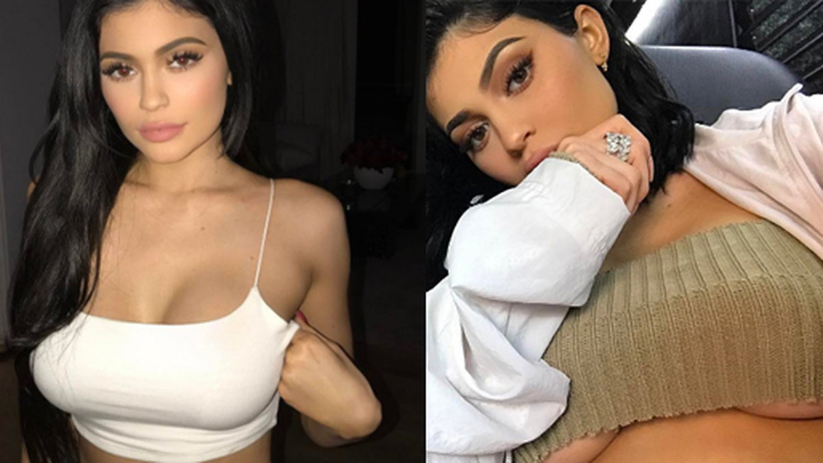 I en ny fotografering så avslöjar nu Kylie Jenner sitt operationsärr. 