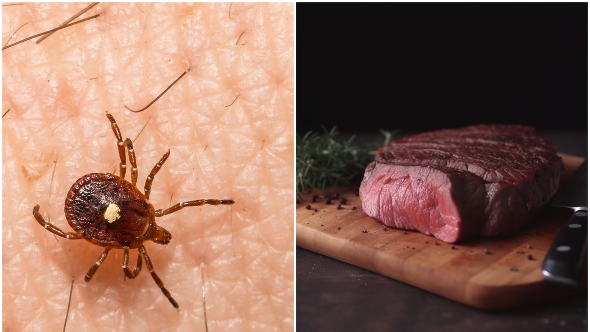 Tillhör du riskgrupperna för att utveckla allergi mot kött?