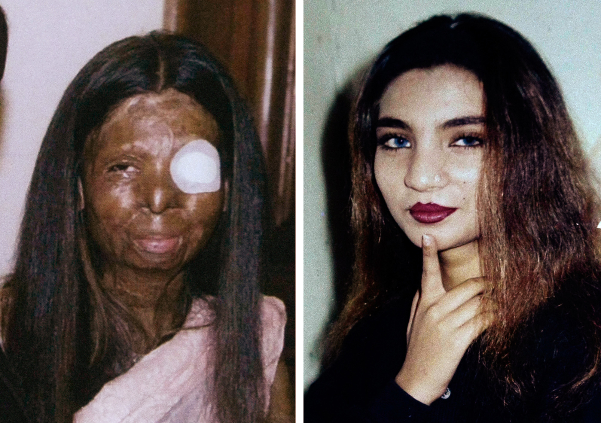 Fakhra Younus, tidigare dansös, före och efter attacken
