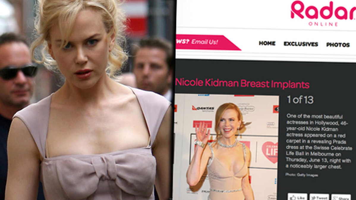 Nicole Kidman före och efter.