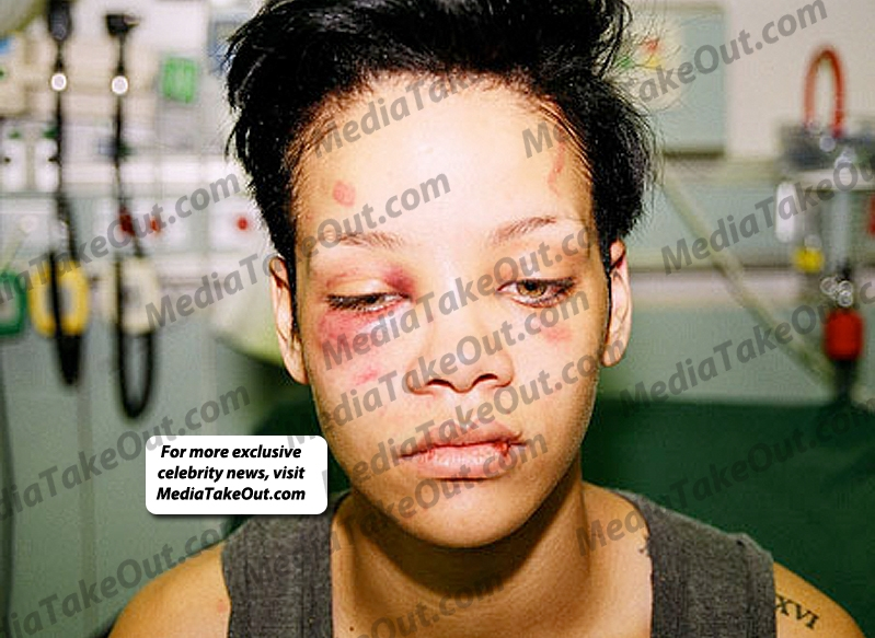Rihanna fick ta emot flera knytnävsslag i ansiktet. 