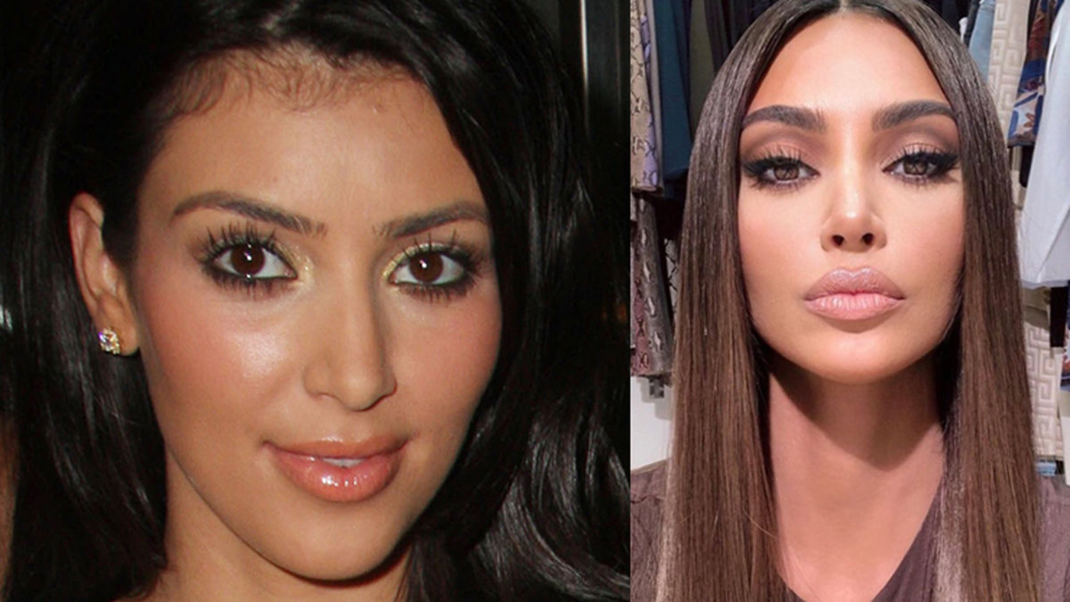 Kim Kardashian före och efter