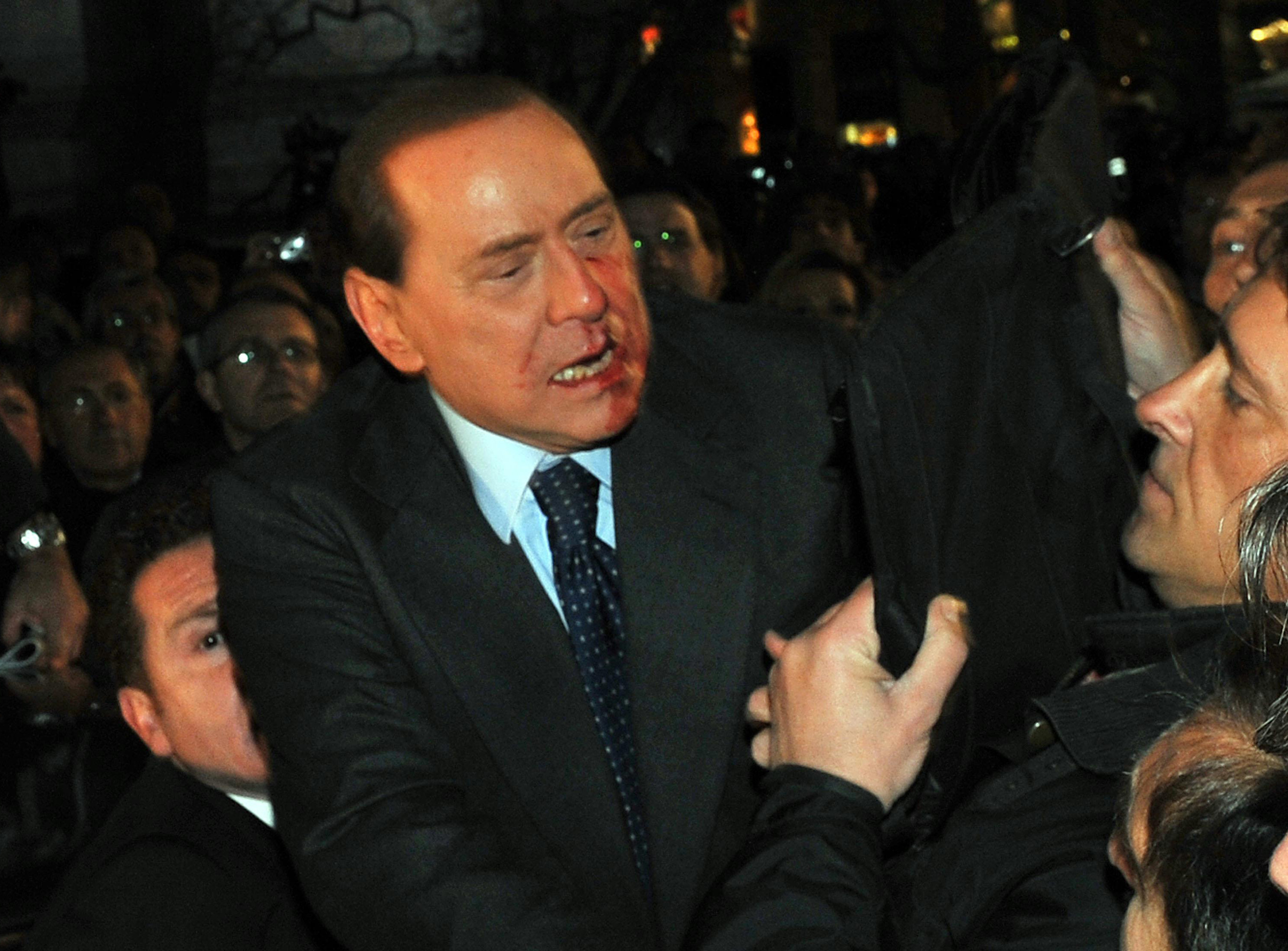 Massimo Tartaglia, Silvio Berlusconi, Attack, Milano, Italien, Berlusconi