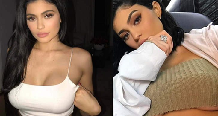 Kylie Jenner, Operation, Bröstoperation